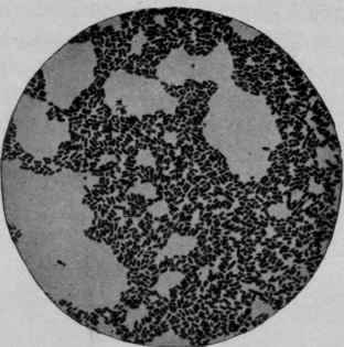 Bacillus Typhosus, from a Twenty four hour old Agar agar Culture. X 650 (Heim).