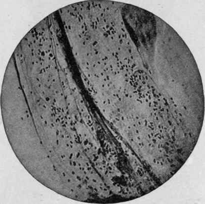 Bacillus of Influenza. Smear from Sputum (after Heim).