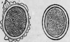 Eggs of Ascaris Lumbricoides (Mosler and Peiper).