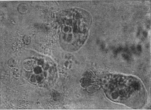 Entamceba Histolytica. Living Organisms. Note absence of Nucleus.