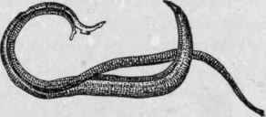 Human Blood Fluke (schistoma or dlstoma Haematobium). X 5 (Leuckart).