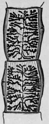 Mature Segments of TAenia Solium (Mosler and Peiper).