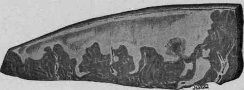 Part of Spleen the Seat of Multiple Anemic Infarcts (Coplin).
