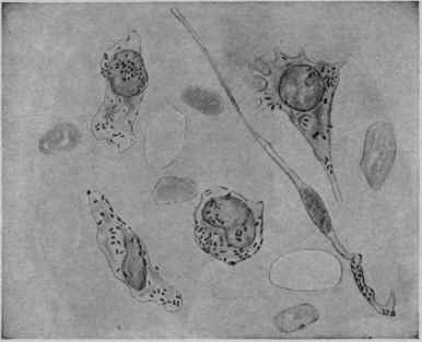 Phagocytosis: the Omentum Immediately after Injection of Typhoid Bacilli into a Rabbit.