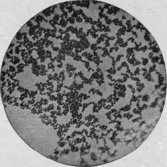 Staphylococcus Pyogenes Aureus, from an Agar agar Culture. X 1000 (G�nther).