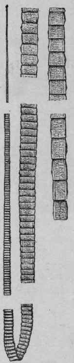 Taenia Solium (Mosler and Peiper).