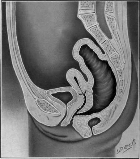 Fig. 11. Atreus an vaginal is.