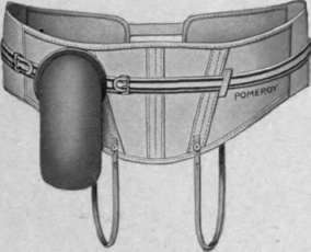 Fig. 24. Colostomy bag and bandage which may be made for either right or left side.
