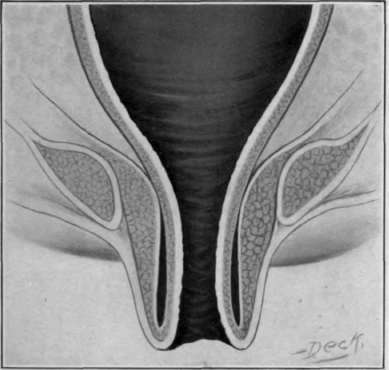 Fig. 28. Complete rectal prolapse, first degree.