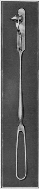 Fig. 56. Trochaic for insertion of female segment of MorphyÃ¢s button in Bacon's operation for stricture of the rectum.