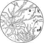 A Greenish Pelliele found in the Wash water of the Stomach (of Wm.R     ).