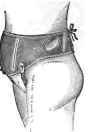 Bandage with Holes over the mac Crests, and Strups. around the Legs as.