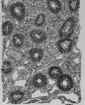 D Small Pieces Of Gastric Mucosa 27