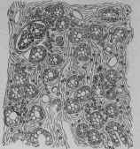 D Small Pieces Of Gastric Mucosa 35