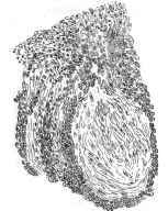 Showing One Spot of a Proliferation of Cells lying in the Centre of the Specimen.