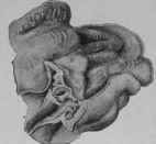 The same specimen drawn in smaller proportions, in order to show the surroundings of the ulcer.