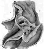 Ulcer of the Stomach near the Pylorus, the latter being stenosed.