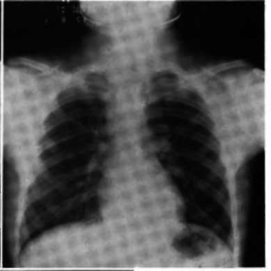 Clinical Classification 157