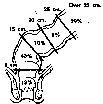 Distribution of carcinomas of the rectum and colon detected sigmoidoscopically