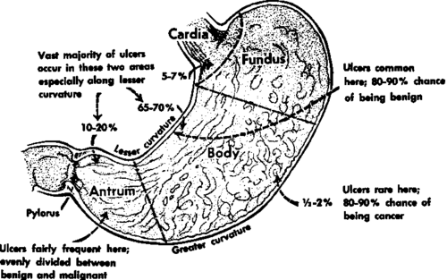 Location of gastric ulcers
