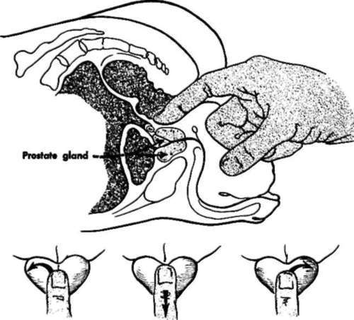 Technique for examination of the prostate gland