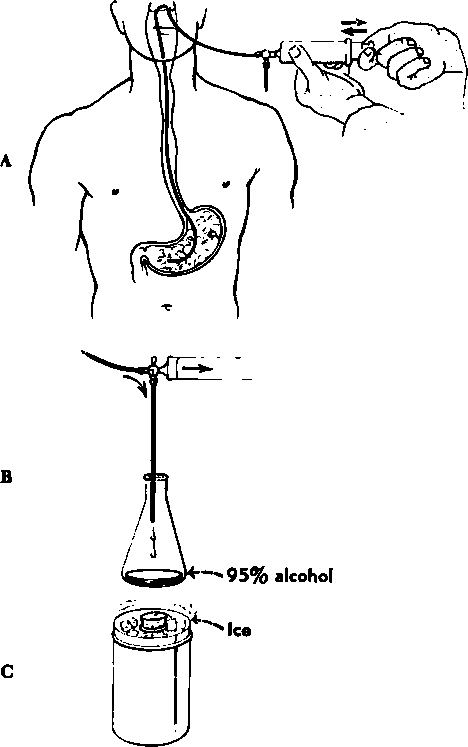 Technique of chymotrypsin lavage