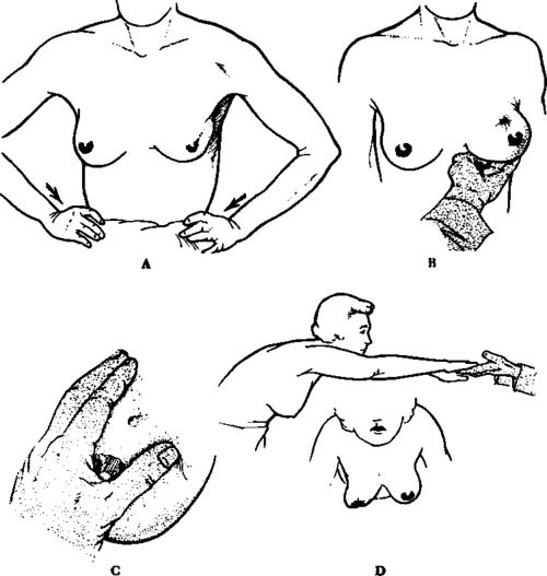 Techniques used in demonstrating retraction phenomena in localized lesions of the breast
