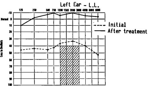 Manifest improvement in the impaired hearing is obtained in a subject with acid pattern