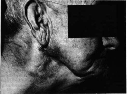Skin reactions 2