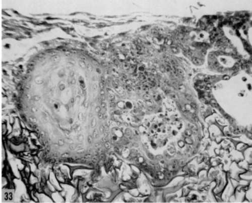 Culture similar to that shown in figure 32