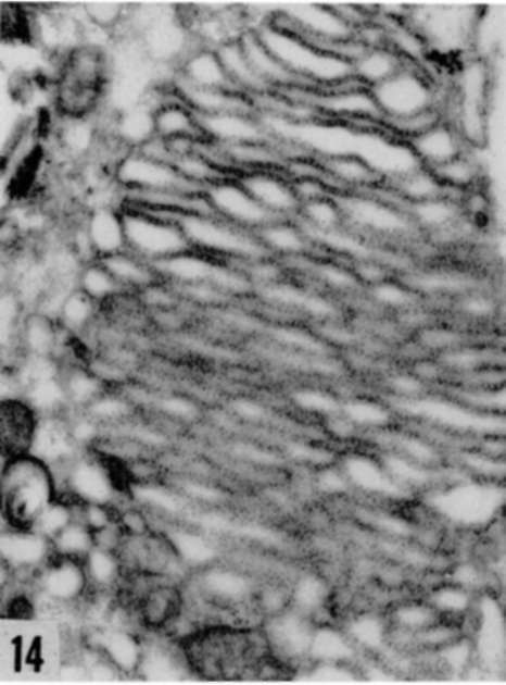 Different aspects of increase in ergastoplasm in Rous virus infected cells