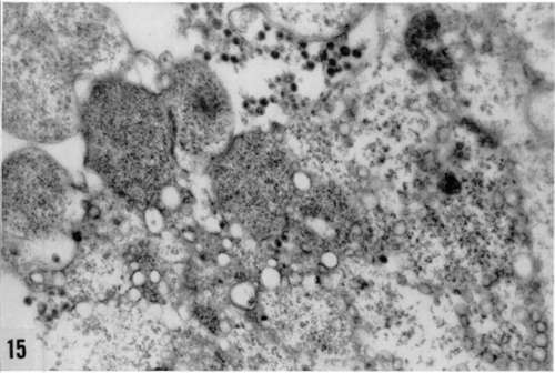 Different aspects of increase in ergastoplasm in Rous virus infected cells