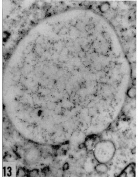Different aspects of increase in ergastoplasm in Rous virus infected cells