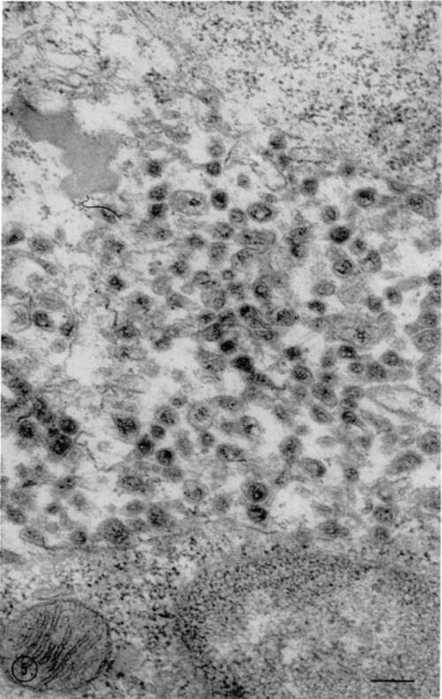 Electron micrograph of part of section through lymph node of leukemic mouse