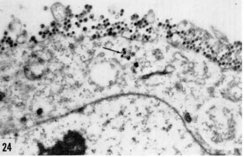 Extracellular types of virus particles found in cells