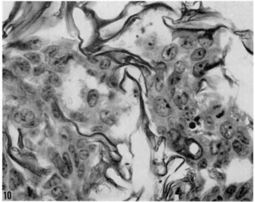 Higher magnification of area shown in figure 7