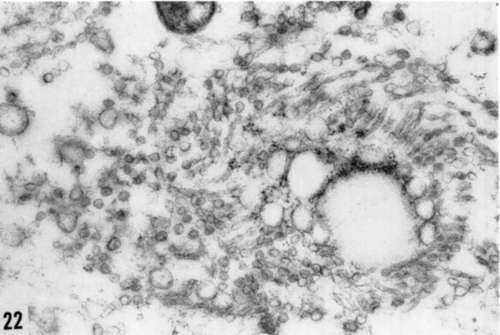 Increase in cytoplasmic vesicles