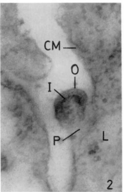 Liver of leukemic mouse