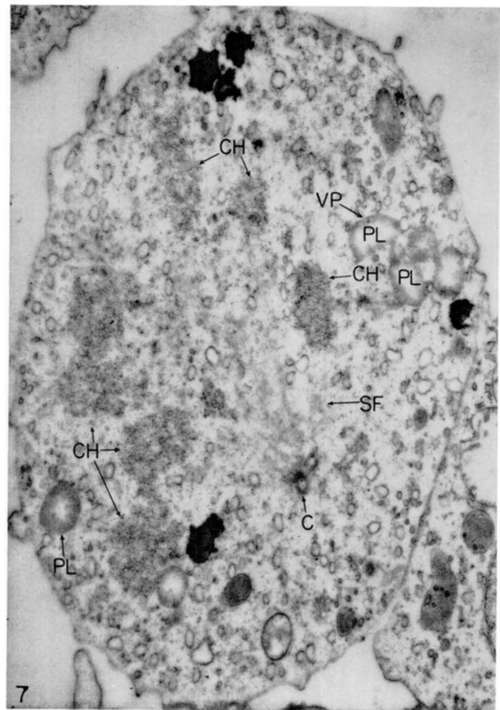 Mitotic figure of mycloblast from growing culture 2 days old