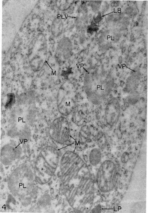 Myeloblast from growing culture 2 days old