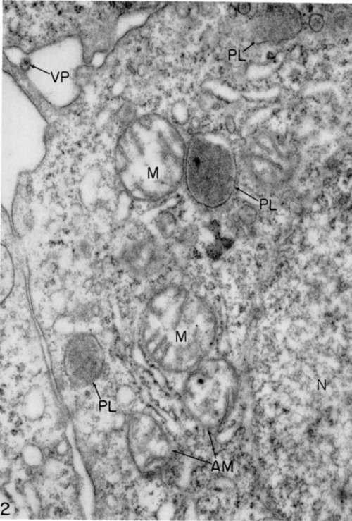 Myeloblast from same source as that of figure 1 after 2 hours in tissue culture