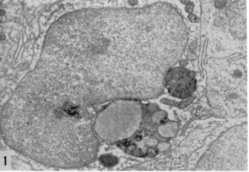Normal looking and relatively well preserved nucleus of human breast cell