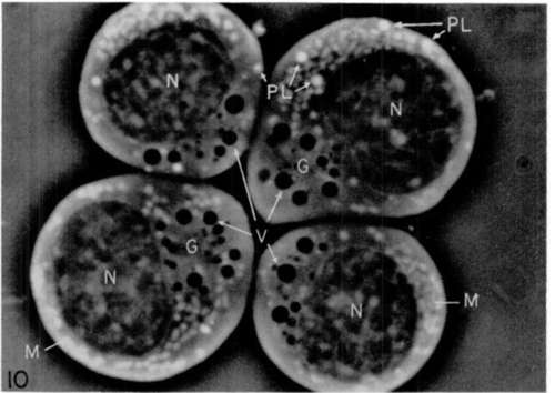 Phase contrast photograph of living cells from growing culture of myeloblasts