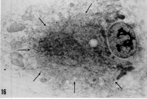 Remarkably hypertrophied cellular center in Rous sarcoma