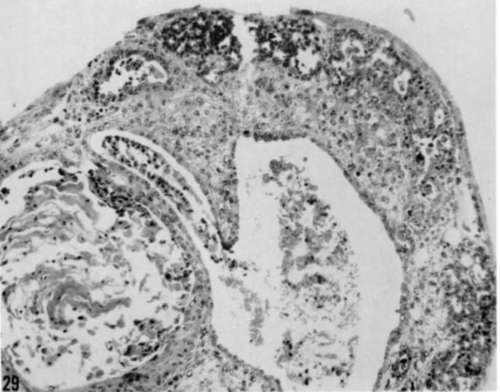 Section of culture similar to that shown in figure 25