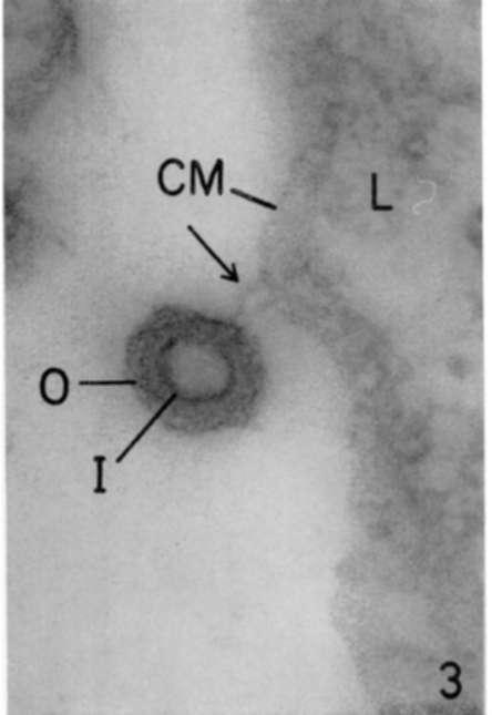 Spleen of leukemic mouse