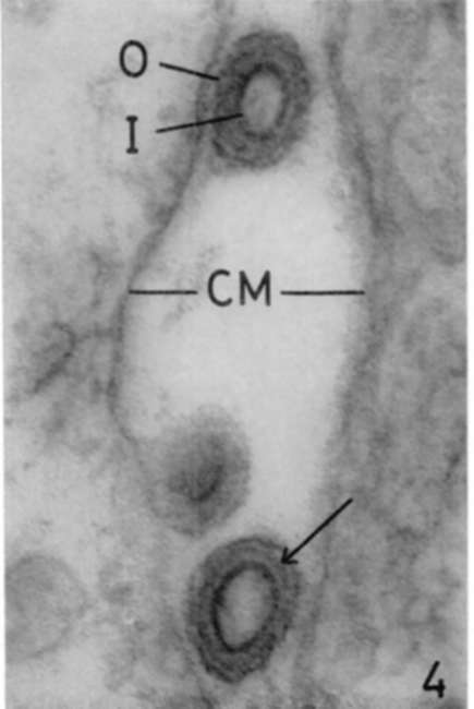 Three viruses are seen in intercellular space