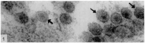 electron dense nucleoid