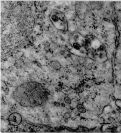 shows portion of cell from lymph node of leukemic mouse