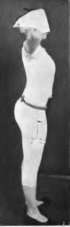 The same person standing poise corrected and abdomen held up by a spring supporter.